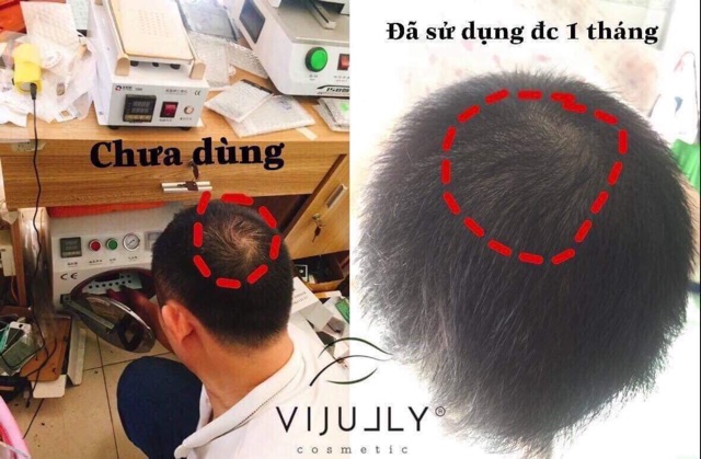 [Tặng Quà Hot] Tinh Dầu Bưởi Vi Jully 100% Thiên Nhiên KÍCH MỌC TÓC-TRỊ RỤNG TÓC-TÓC NHANH DÀI, DÀY | Thế Giới Skin Care