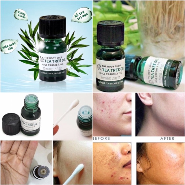 Tinh Dầu Chấm Mụn Tea Tree Oil, Giảm Mụn, Mờ Thâm The Body Shop