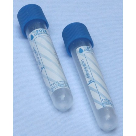 Ống lấy máu chân không chứa ACD dùng trong PRP
