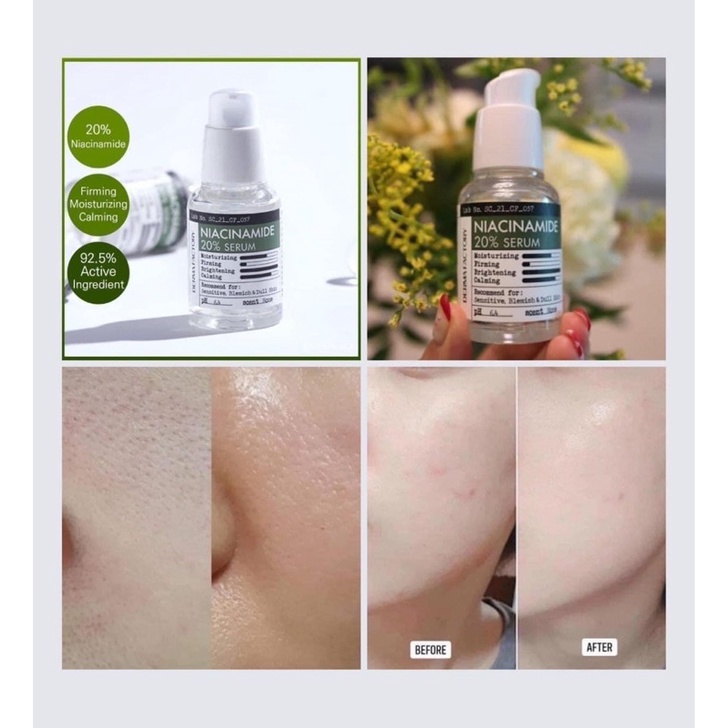 SERUM se khít lỗ chân lông 🌺🌺 𝐍𝐢𝐚𝐜𝐢𝐧𝐚𝐦𝐢𝐝𝐞 𝟐𝟎% của nhà DERMA FACTORY