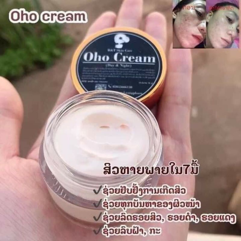 🖤Kem Oho cream ✨kem giảm mụn dưỡng mặt trắng☺