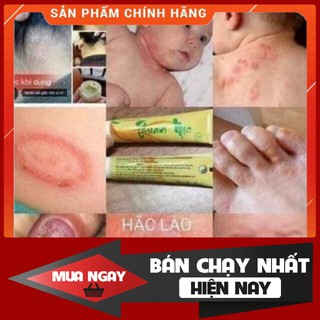 DTB Sale Nấm Ngứa, Hắc Lào, nước ăn chân, côn trùng đốt Th.uần Mộ.c - Th.anh Mộ.c H.ương [ CHÍNH HÃNG ] Hàng có sẵn PTS