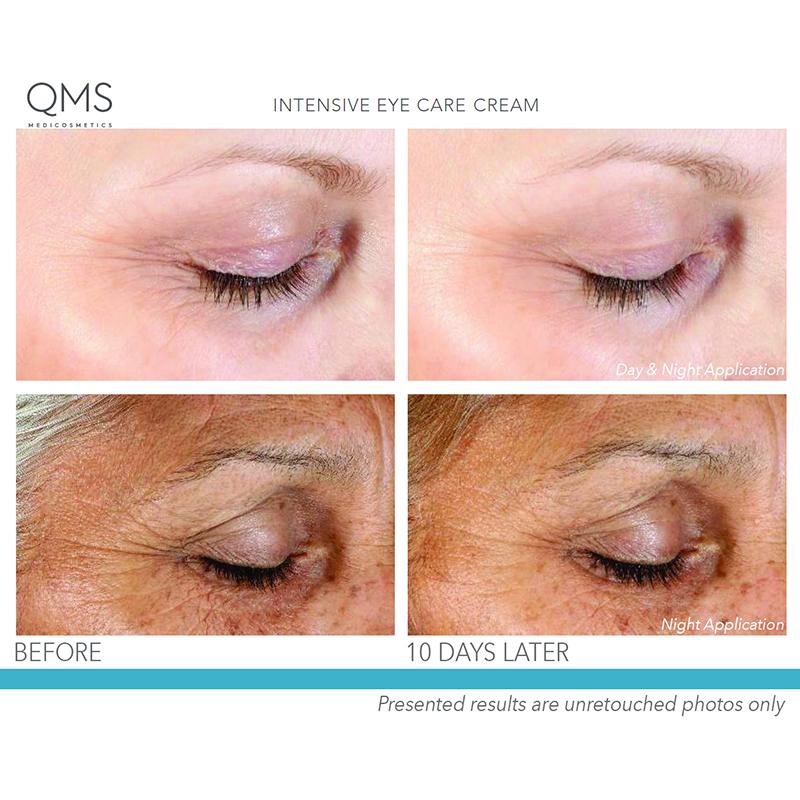 Kem dưỡng mắt QMS Intensive Eye Care Day &amp; Night Cream