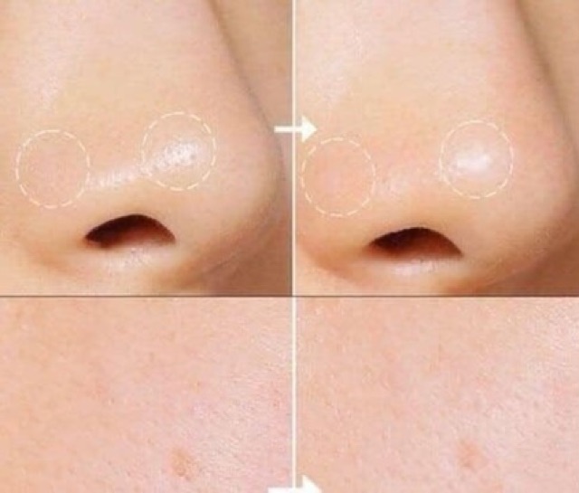 Toner / Nước Hoa Hồng Innisfree 200ml