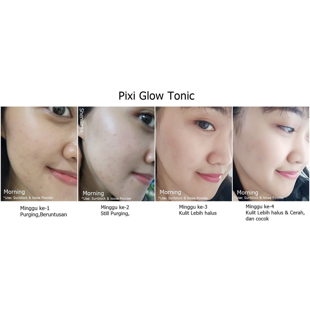 Pixi ☘ Toner tẩy da chết, chống lão hóa, cân bằng giữ ẩm Glow Tonic / Retinol Tonic / Vitamin C Tonic