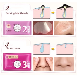 SET LỘT MỤN 3 BƯỚC BIOAQUA