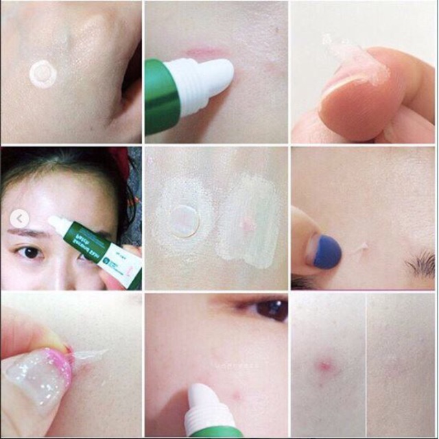 GEL VÁ DA THẦN THÁNH SECOND SKIN PATCH Prreti