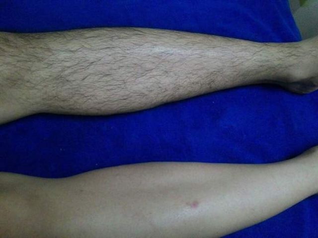 Gel Triệt Râu Lông Vĩnh Viễn Tận Gốc Dưỡng Da Không Mọc Lại | BigBuy360 - bigbuy360.vn