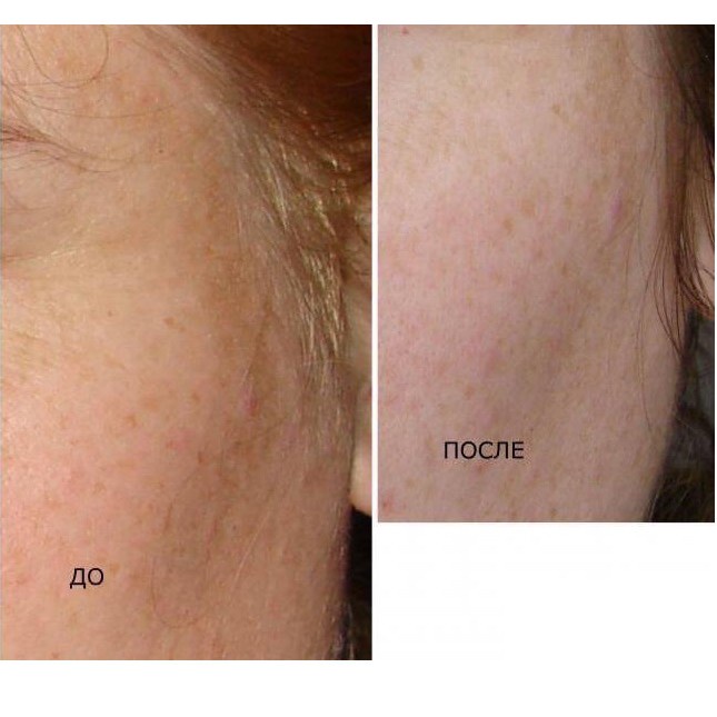 kem nám tàn nhang Kpem Cream mờ nám tàn nhang đ𝐨̂̀𝐢 𝐦𝐨̂̀𝐢 dưỡng da tay dưỡng ẩm da phục hồi da 𝐓𝐚̣̆𝐧𝐠 𝐦𝐚́𝐲 𝐦𝐚𝐬𝐬𝐚𝐠𝐞