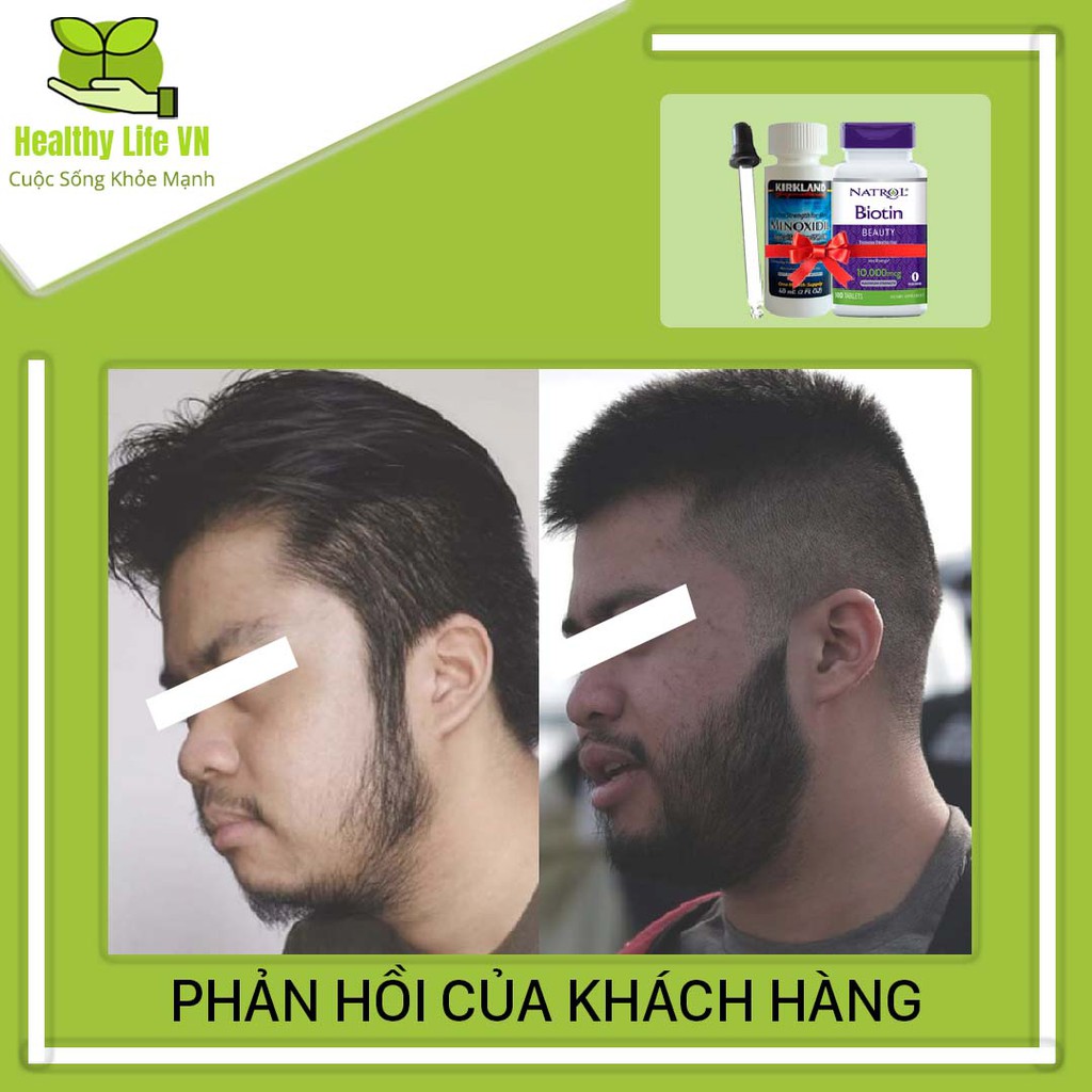 Minoxidil 5% Mọc Râu Dạng Lỏng Kirkland Combo Biotin