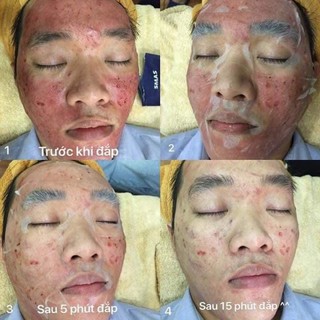 [10 miếng] Mặt nạ SMAS Peptide Silk Mask
