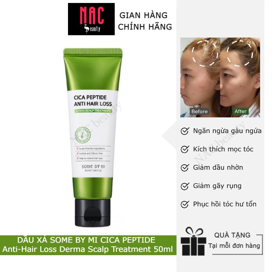 Dầu Xả ngăn ngừa rụng tóc Some By Mi Cica Peptide Anti-Hair Loss Derma Scalp TREATMENT 50ml