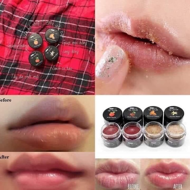 Tẩy tế bào chết môi Beauty Treats Lip Scrub (10gram) | BigBuy360 - bigbuy360.vn