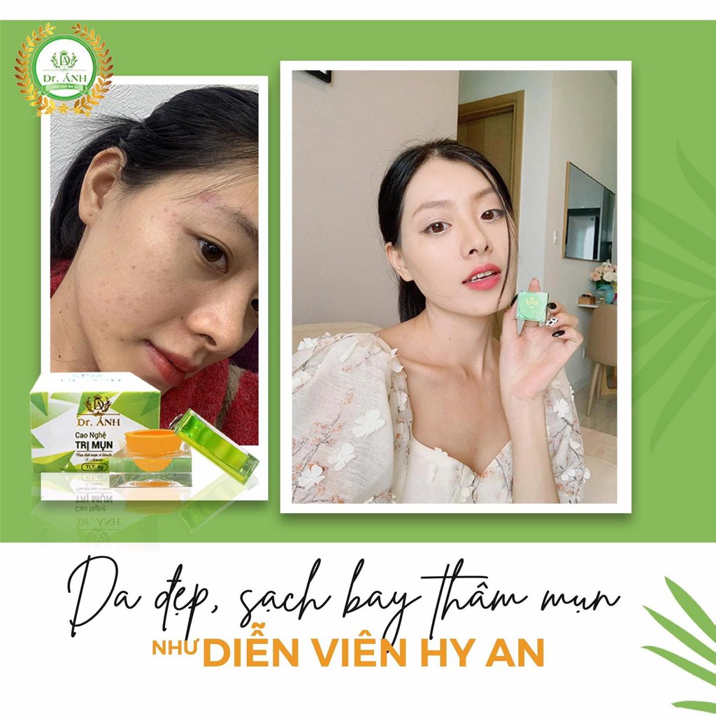 Cao Nghệ Dr.Ánh [Chính Hãng] mờ thâm, bay mụn | BigBuy360 - bigbuy360.vn