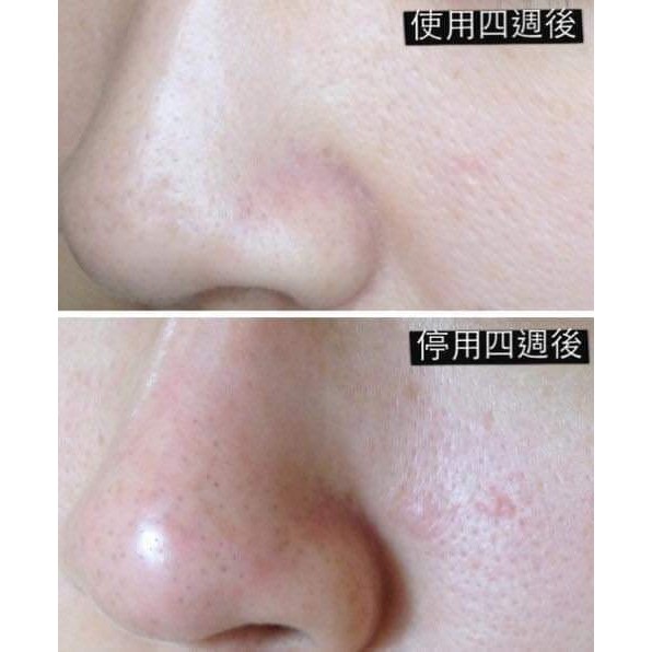 Serum drwu MA  8% và 18% Dr.wu các loại