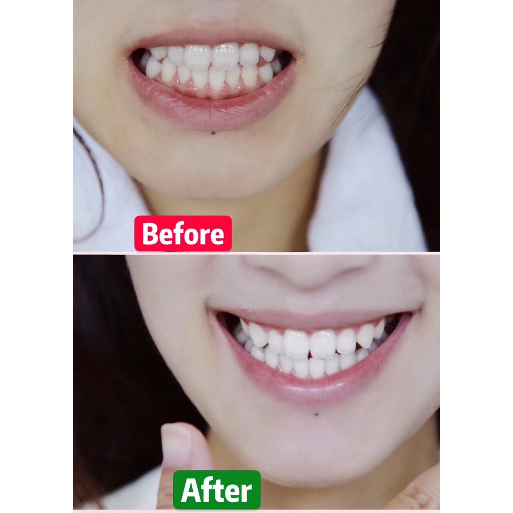 CREST Kem Đánh Răng Khóa Trắng 3D Loại Bỏ Vết Bẩn Vàng