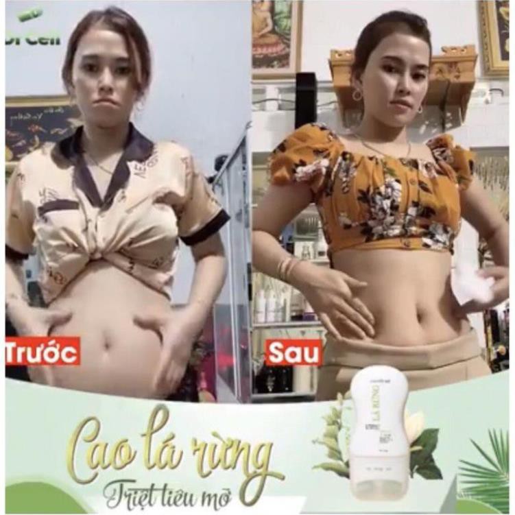 Kem Tan Mỡ - Cao Đốt Mỡ Lá Rừng Dr Cell - Tặng Đai Định Hình 450k