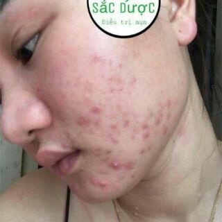 Sữa rửa mặt thảo mộc thiên nhiên
