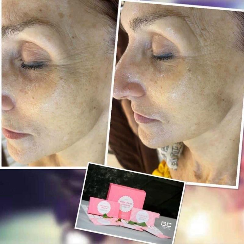 Gel Nâng Cơ Xóa Nhăn CareCella Facial line up lifting gel 1 hộp/4 gói x 9ml, tuyển sỉ, CTV IB