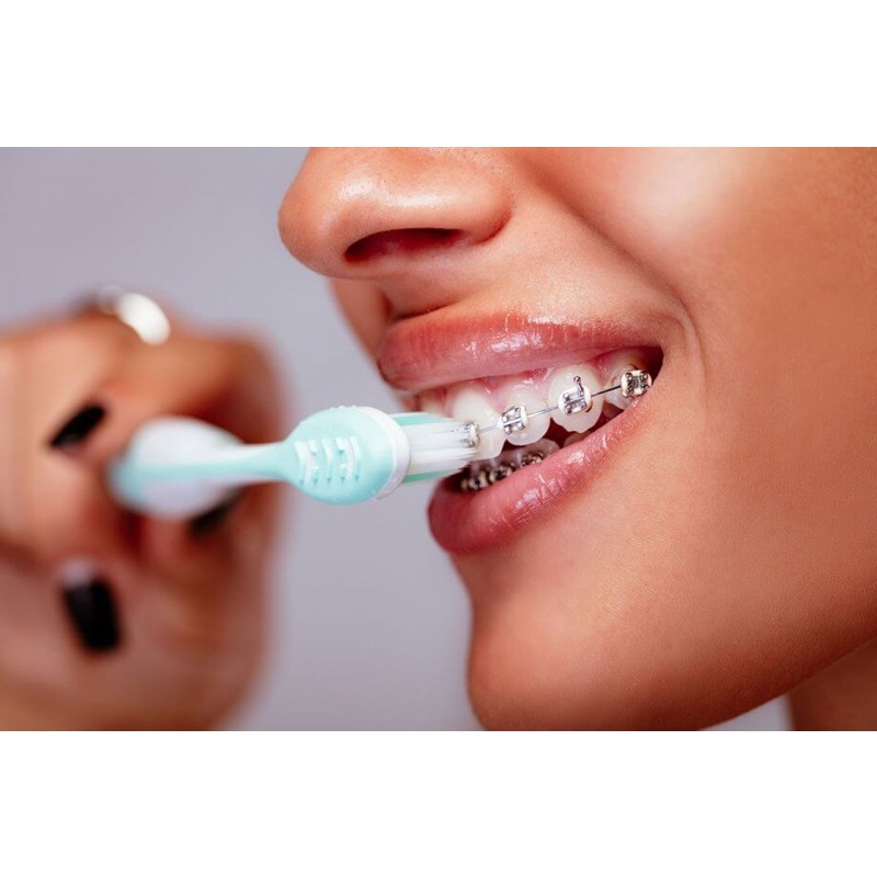 WhiteFoam Leblanc làm sạch máng chỉnh nha trong suốt như Invisalign