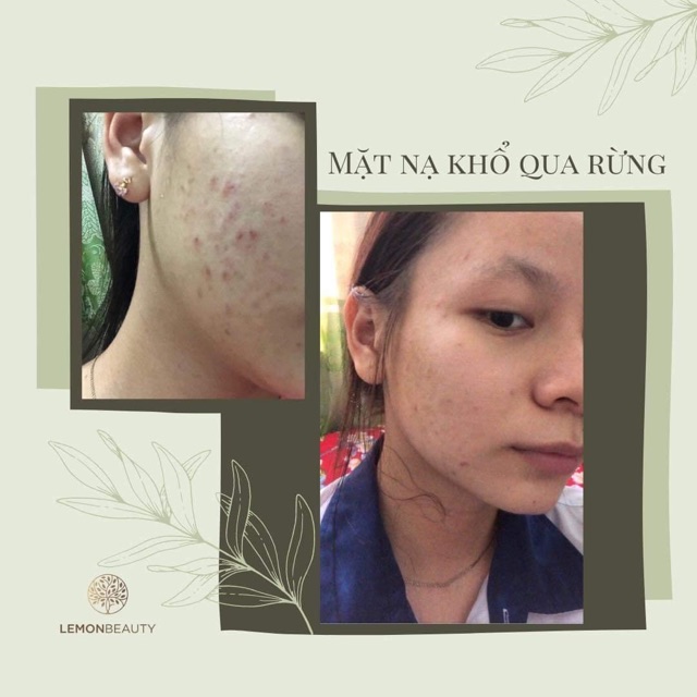 Mask Khổ Qua Rừng tặng cọ quét