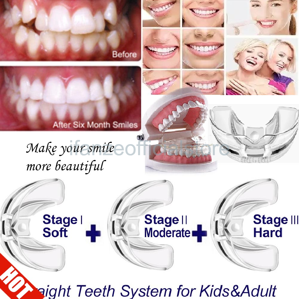 [Hàng mới về] Bộ 3 hàm niềng năng chỉnh nha/ làm trắng răng 3 giai đoạn dành cho người lớn