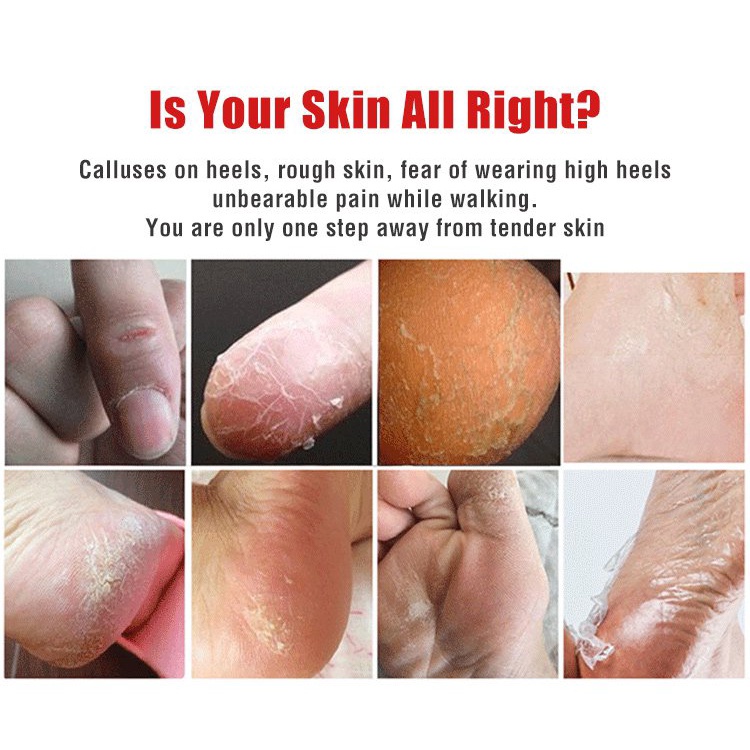 Kem Dưỡng Da Tay Vaseline Dưỡng Ẩm Chống Nứt Nẻ/Lão Hóa Cải Thiện Làn Da Khô 80g