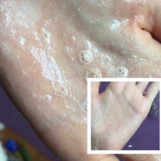Sữa Rửa Mặt #La-Roche #Posay #Effaclar