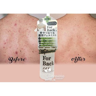Chai xịt giảm MỤN LƯNG "For Back" 100ml - Nhật Bản