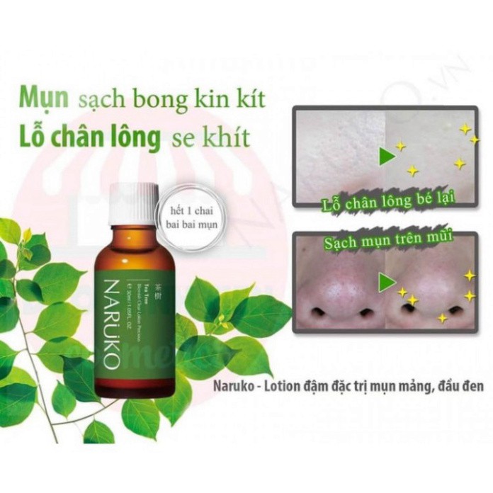 NARUKO - Lotion Tràm Trà Đậm Đặc Giảm Mụn Mảng, Mụn Đầu Đen 30ml – Tea Tree Blemish Clear Lotion Precious 30ml U81