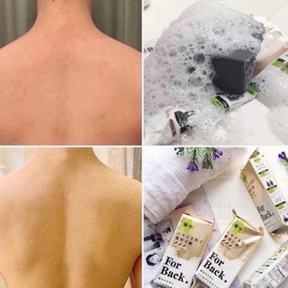 Xà Phòng Hết Mụn Lưng For Back