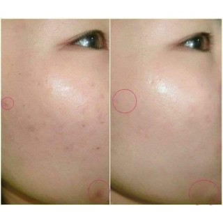 VitaminC Cinal C Nhật