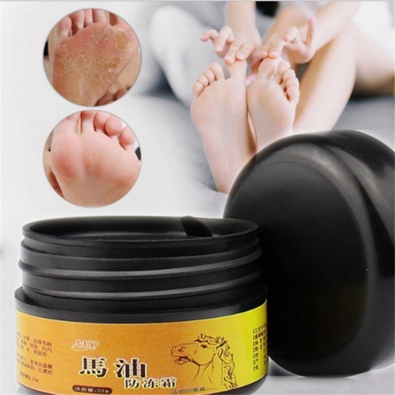 Kem hỗ trợ giảm nứt nẻ gót chân từ mỡ ngựa giữ ẩm và cải thiện da