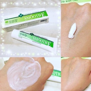 Kem lành thâm sẹo mụn Smoothe
