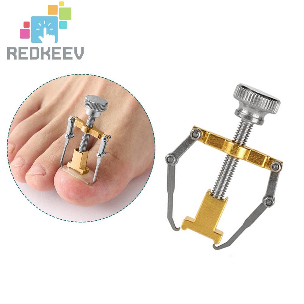 Dụng Cụ Chỉnh Sửa Móng Chân Mọc Ngược