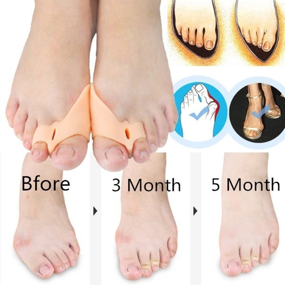 Dụng cụ tách ngón chân giảm đau có thể tái sử dụng