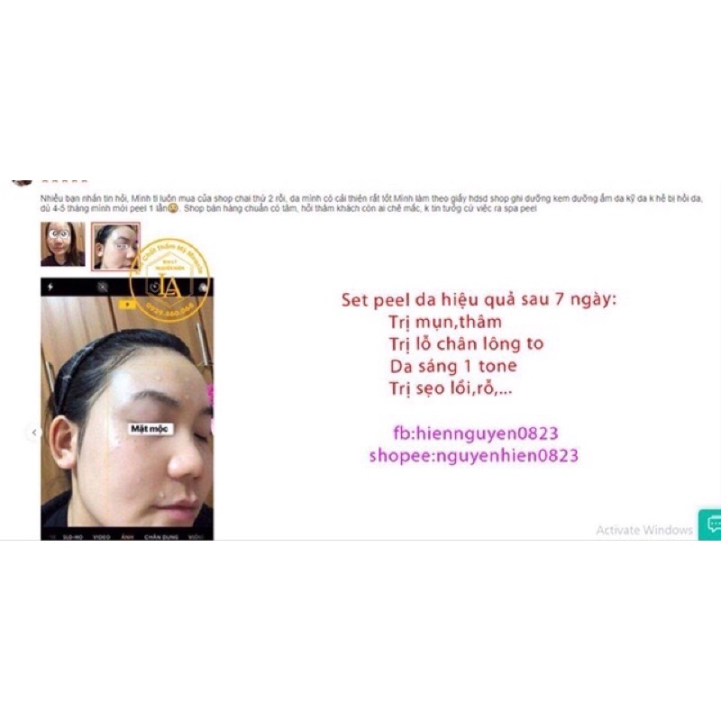 Thay Da Sinh Học Peel TCA Zenus