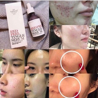 Peel red Hàn Quốc