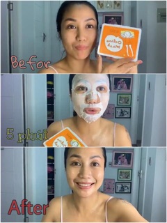 MẶT NẠ TRẮNG DA MỜ THÂM NÁM KOSXU (Hộp 30 miếng)