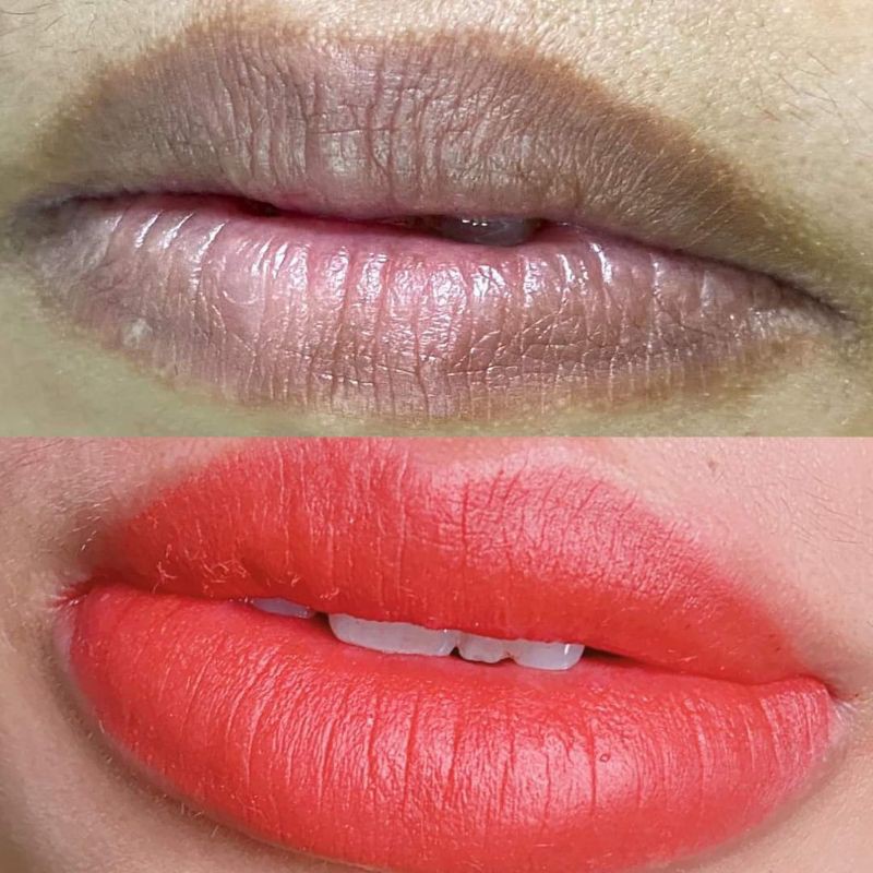 COLAGEN B5 dưỡng môi sau xăm