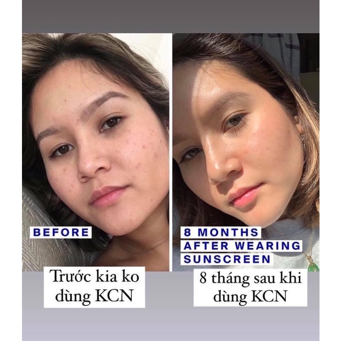Kem Chống Nắng Farmona Sun Face Cream Oil Free SPF50 | BigBuy360 - bigbuy360.vn
