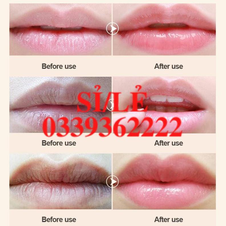 [ CHÍNH HÃNG ] Hộp 20 miếng mặt nạ dưỡng môi Hiisees chiết xuất hoa hồng Sena Beauty  HAIANHSHOP