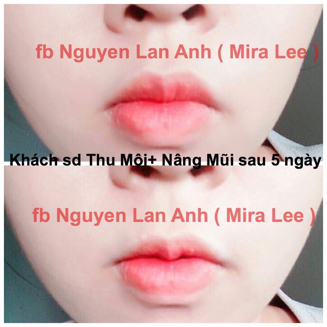 Tinh Chất Thu Nhỏ Môi Miracle