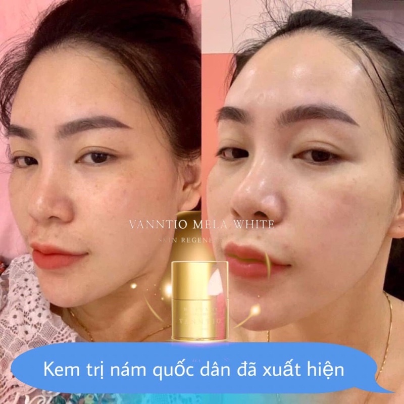 Kem nám VANNTIO Hàn Quốc chính hãng