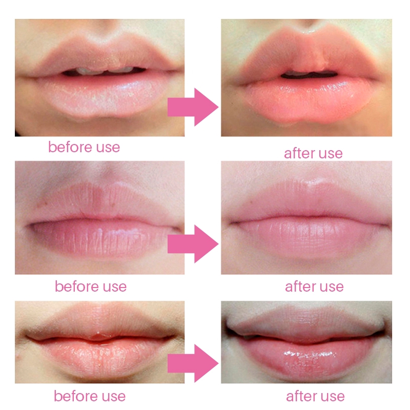 Mặt nạ môi collagen dưỡng ẩm da chống lão hóa và nếp nhăn