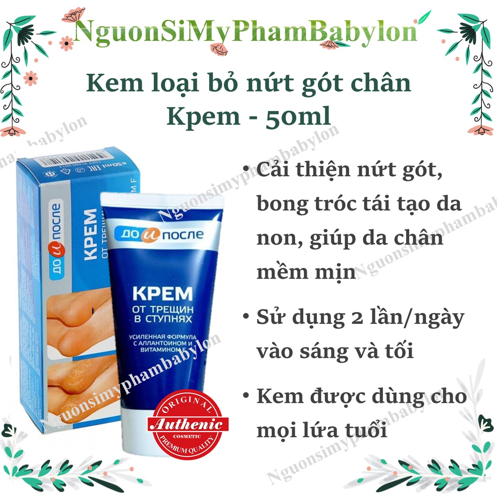 KEM LOẠI BỎ NỨT GÓT CHÂN KPEM_KEM  NỨT GÓT CHÂN NGA