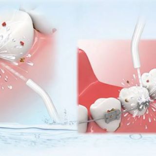 Dụng cụ vệ sinh răng miệng Power Floss