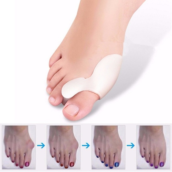 Dụng cụ tách ngón chân bằng silicon hỗ trợ chăm sóc bàn chân có ngón chân biến dạng