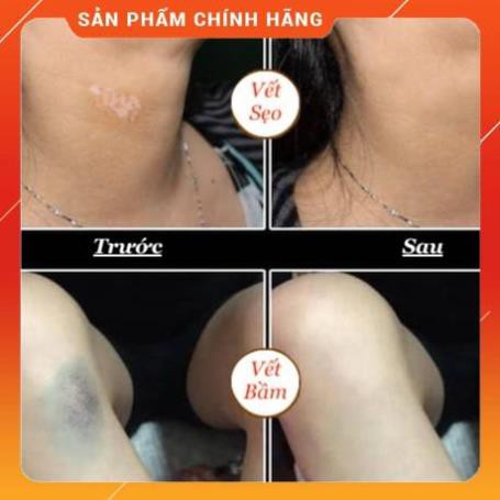 Kem Che Hình Xăm, Khuyết Điểm - Cover Up Tattoo 30g