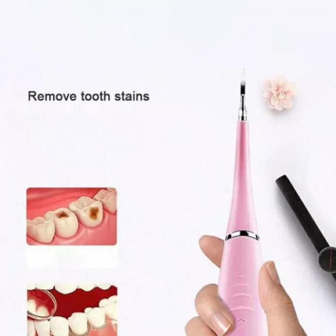 Máy Lấy Cao Răng Cầm Tay Mini 3 Chế Độ Rung Loại Sạch Mảng Bám Cao Răng Vết Ố Cứng Đầu Nhất
